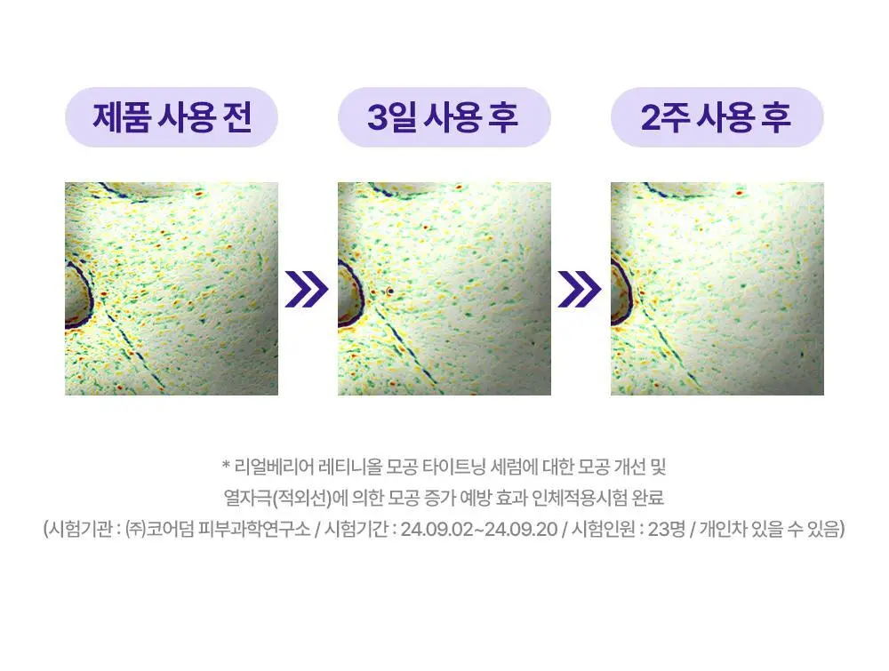 [모공축소] 리얼베리어 레티니올 모공 타이트닝 세럼 30ml 기획 (+10ml) 상세페이지 18
